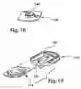 Fig. 07 - Modular intervertebral implant