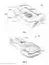 Fig. 02 - Interveterbral disc prosthesis insertion assemblies