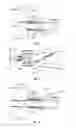 Fig. 07 - Interveterbral disc prosthesis insertion assemblies