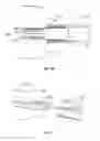 Fig. 08 - Interveterbral disc prosthesis insertion assemblies