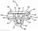 Fig. 01 - Trial implant assembly