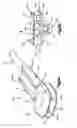 Fig. 06 - Trial implant assembly