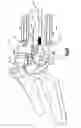 Fig. 09 - Trial implant assembly