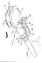 Fig. 30 - Trial implant assembly