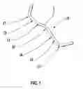 Fig. 02 - Prosthetic joint