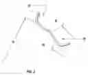 Fig. 03 - Prosthetic joint