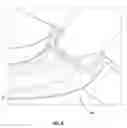 Fig. 06 - Prosthetic joint