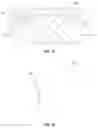 Fig. 11 - Prosthetic joint