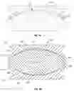 Fig. 13 - Prosthetic joint