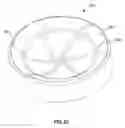 Fig. 15 - Prosthetic joint