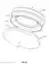 Fig. 16 - Prosthetic joint