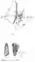 Fig. 02 - Tooth movement system and method