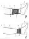 Fig. 02 - Sock with Grip