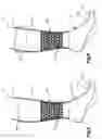Fig. 03 - Sock with Grip