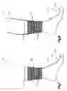 Fig. 05 - Sock with Grip