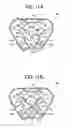 Fig. 09 - Impact detector and packaging container