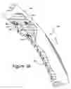 Fig. 04 - Adjustable palm swells for a steering wheel