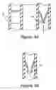 Fig. 07 - Adjustable palm swells for a steering wheel