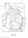 Fig. 15 - Air Assisted Seed Dispensing