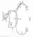 Fig. 06 - Portable pet bathing device