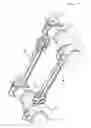 Fig. 09 - Monoblock valveless opposing piston internal combustion engine
