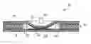Fig. 01 - FILM-TYPE SWITCHING ELEMENT
