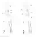 Fig. 04 - Crane