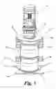 Fig. 02 - Multi-sectional roller mill