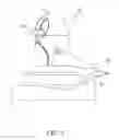 Fig. 06 - Holder and sucker thereof