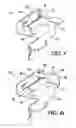 Fig. 05 - Self-correcting conductor positioning bracket