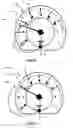 Fig. 02 - Method of displaying a pointer on a display area of a vehicle instrument panel