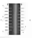 Fig. 08 - High energy proton or neutron source