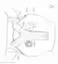 Fig. 05 - UNDER-CHIN HEADPHONE SET