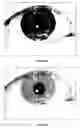 Fig. 06 - Iris data extraction