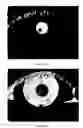 Fig. 07 - Iris data extraction