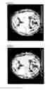 Fig. 10 - IMAGE PROCESSING PROGRAM, IMAGE PROCESSING METHOD AND IMAGE PROCESSOR