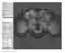 Fig. 01 - Method for searching and constructing 3D image database