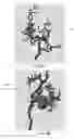 Fig. 06 - Aneurysm detection