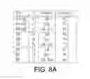 Fig. 08 - Aneurysm detection