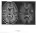 Fig. 05 - Automated image analysis for magnetic resonance imaging
