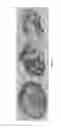 Fig. 06 - Automated image analysis for magnetic resonance imaging