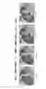 Fig. 07 - Automated image analysis for magnetic resonance imaging