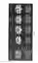 Fig. 08 - Automated image analysis for magnetic resonance imaging