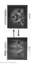 Fig. 09 - Automated image analysis for magnetic resonance imaging