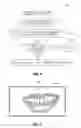 Fig. 06 - TEETH LOCATING AND WHITENING IN A DIGITAL IMAGE