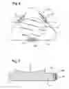 Fig. 06 - COMPOSITE BODY