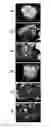 Fig. 01 - DEPHOSPHORIZATION MATERIAL, DEPHOSPHORIZATION APPARATUS, AND DEPHOSPHORIZATION BY-PRODUCT