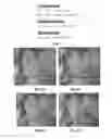 Fig. 02 - METHODS FOR IN VIVO ATHEROSCLEROTIC PLAQUE CHARACTERIZATION USING MAGNETIC SUSCEPTIBILITY TO IDENTIFY SYMPTOM-PRODUCING PLAQUES