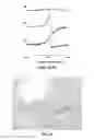 Fig. 04 - METHODS FOR IN VIVO ATHEROSCLEROTIC PLAQUE CHARACTERIZATION USING MAGNETIC SUSCEPTIBILITY TO IDENTIFY SYMPTOM-PRODUCING PLAQUES