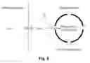 Fig. 06 - METHODS FOR IN VIVO ATHEROSCLEROTIC PLAQUE CHARACTERIZATION USING MAGNETIC SUSCEPTIBILITY TO IDENTIFY SYMPTOM-PRODUCING PLAQUES